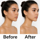 Blemish Care Purifying Toner for Oily Skin - True Colour Beauty