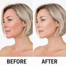 Sensitive Skin Moisturizer | True Colour Beauty