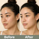 Blemish Care Clay Mask for Pores and Blackheads - True Colour Beauty