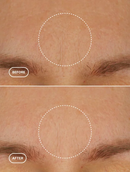 Retinol Alternative Moisturizer