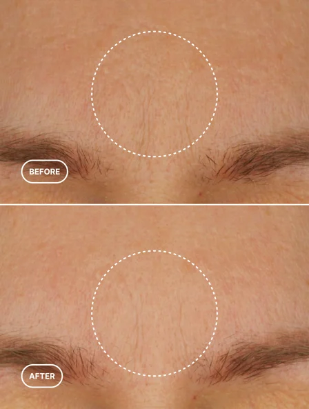 Retinol Alternative Moisturizer