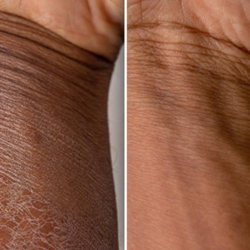 before and after using Shea Body Butter